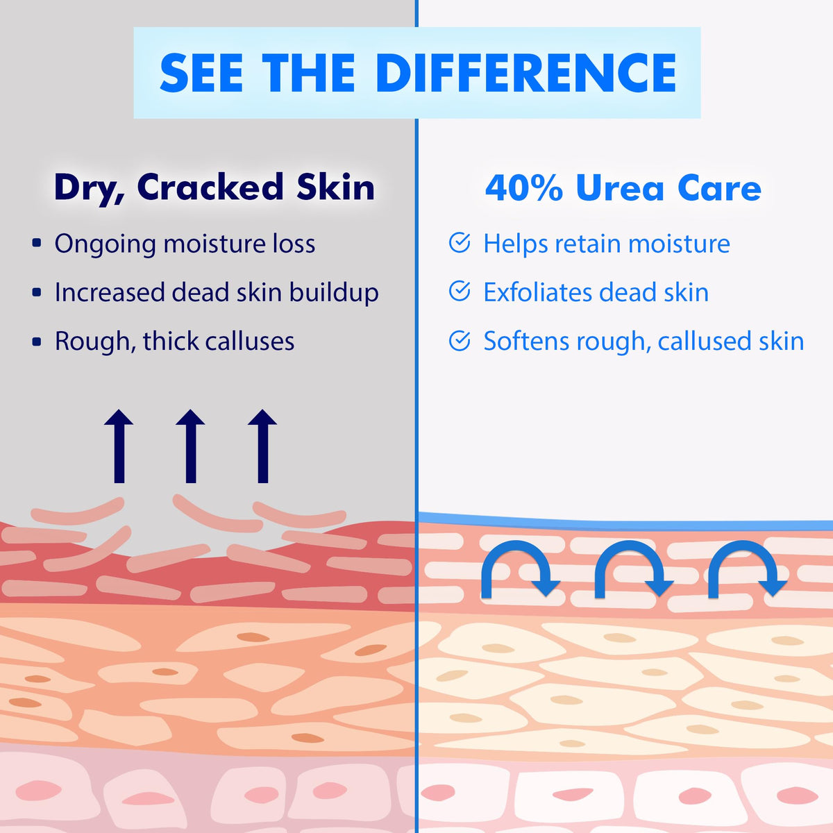 Ebanel Urea Cream 40% plus Salicylic Acid 2% for Dry Cracked Feet Skin, 2PK