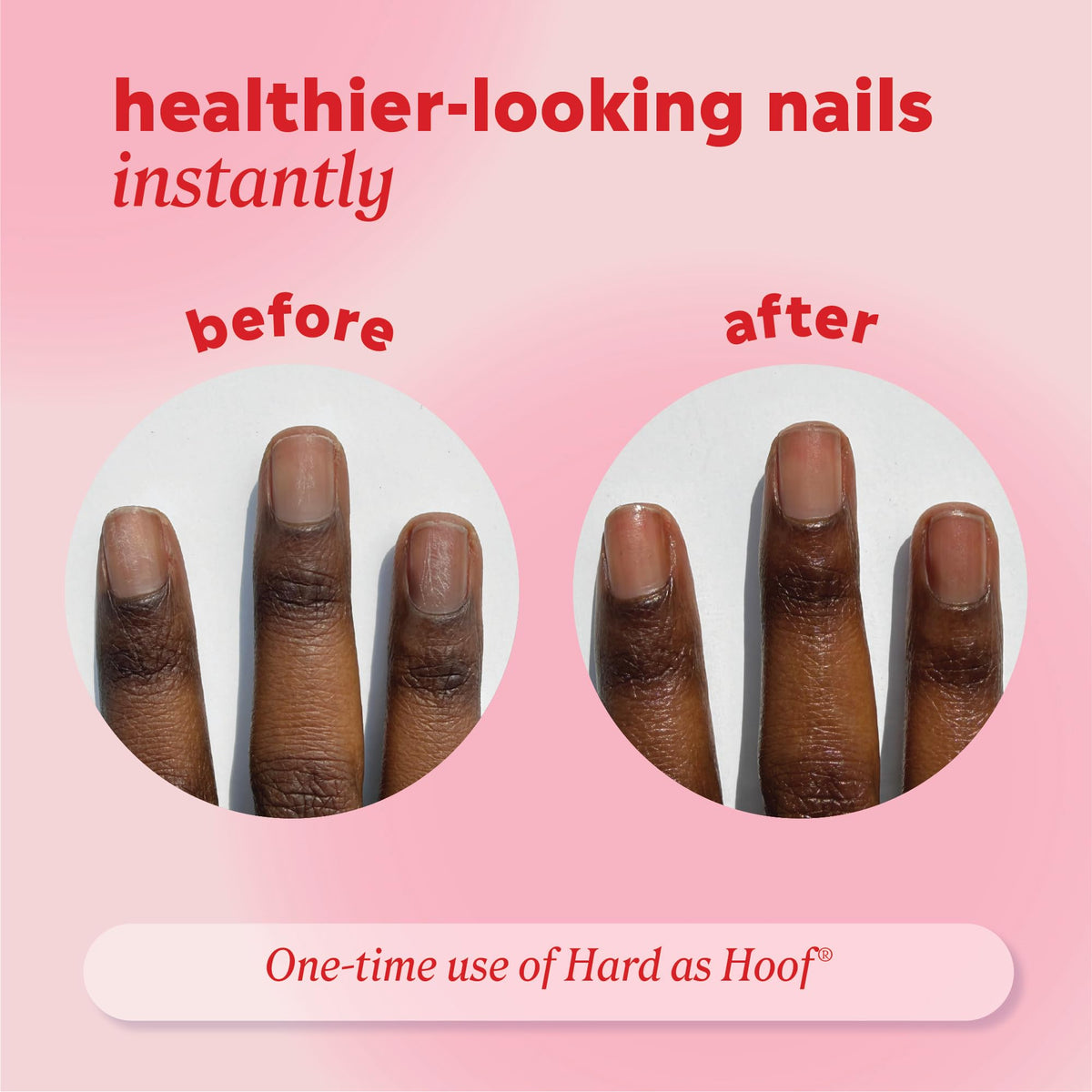 Onyx Professional Hard as Hoof Nail Repair Patches, 20 Patches